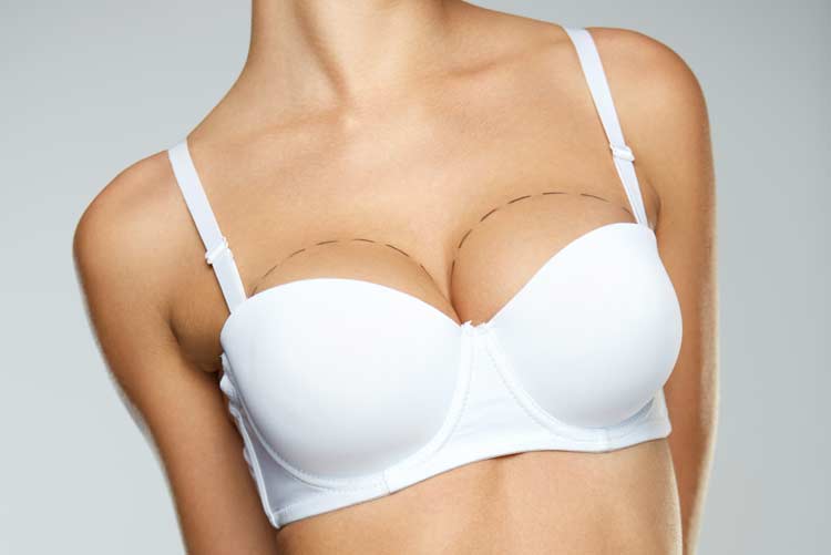 Sagging Breasts Miami