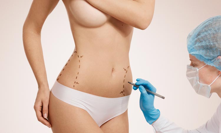 Tummy Tuck Miami
